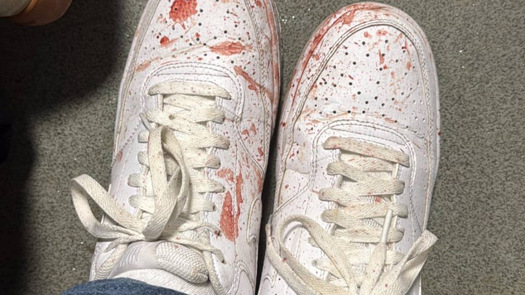 „Az ököl soha nem lehet politikai érv” – véres konfliktussá fajult egy politikai vita három fiatal és a Sepsi futballklub alkalmazottjai között