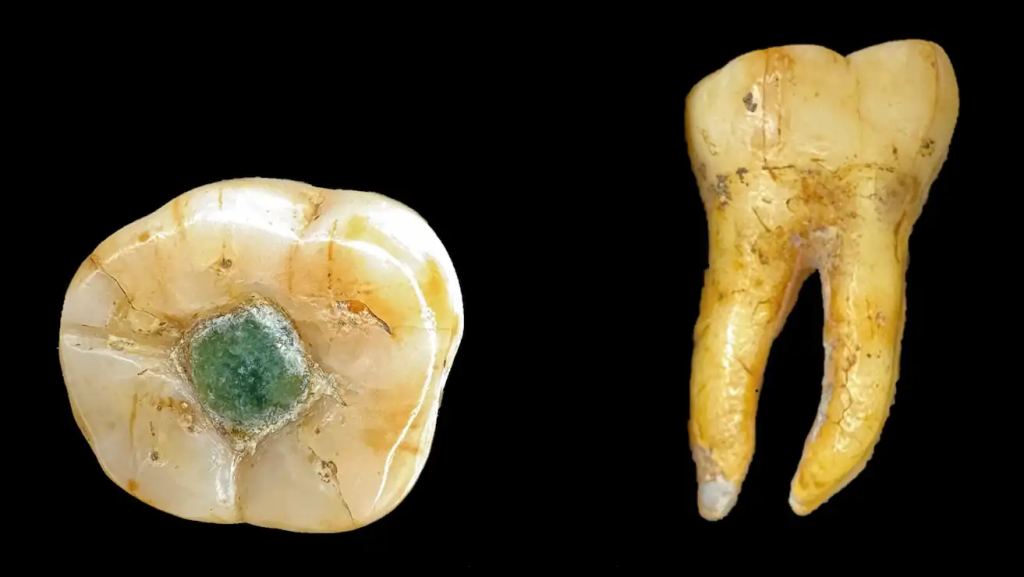 A maják drágakövet használtak fogtömésre