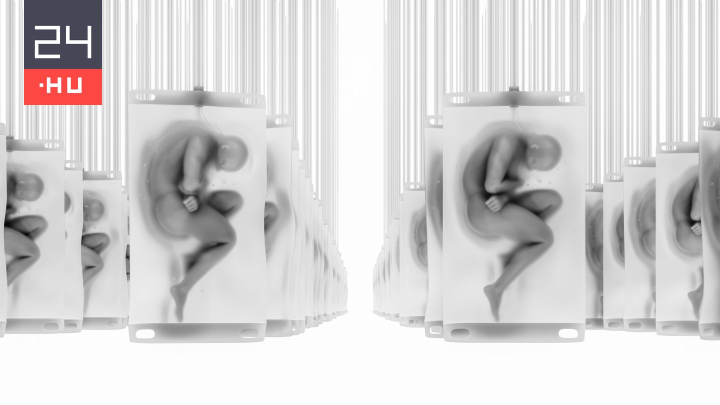 Agy nélküli, emberi klónokat hozna létre egy milliárdosok által támogatott startup