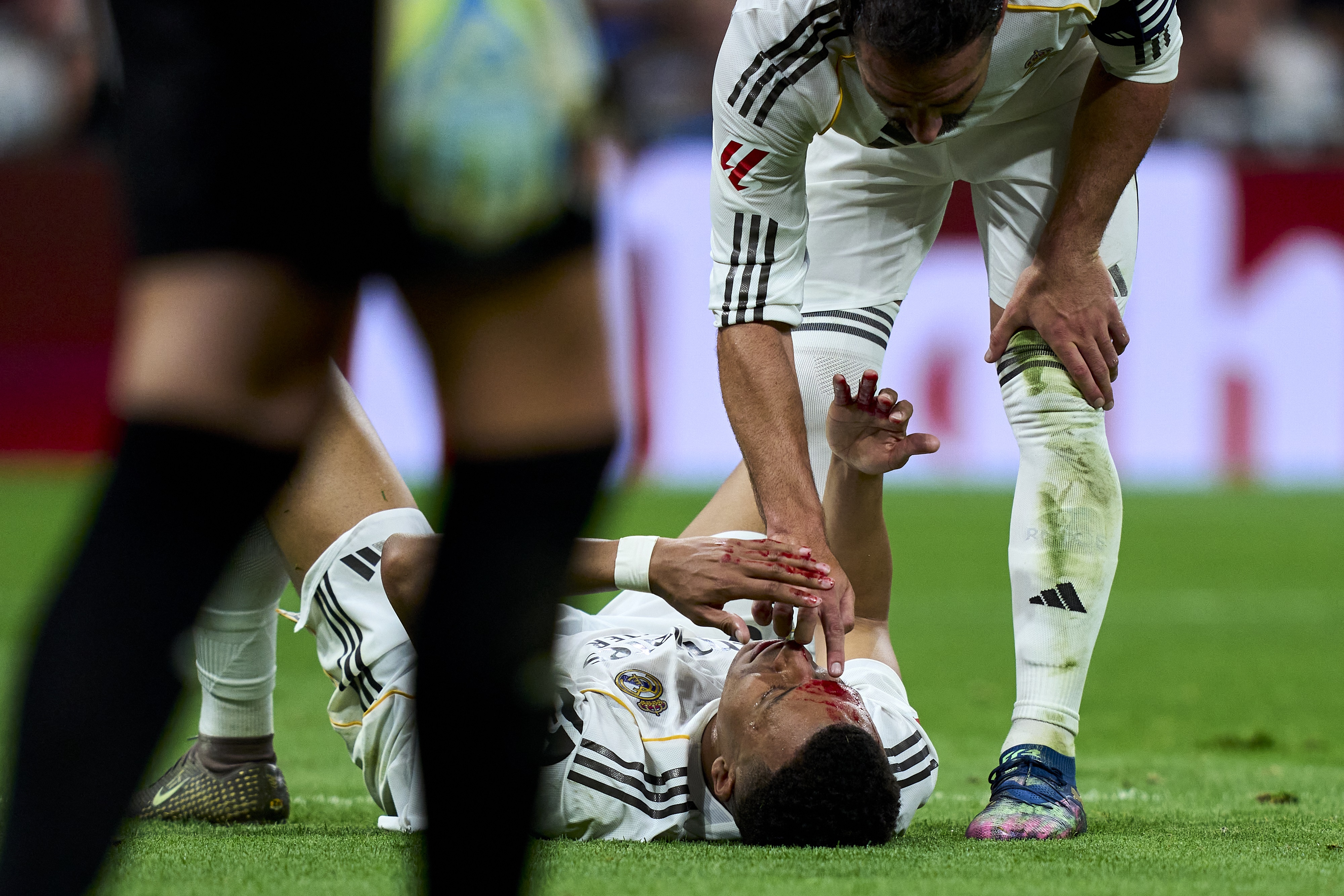 Kylian Mbappé sérülése.