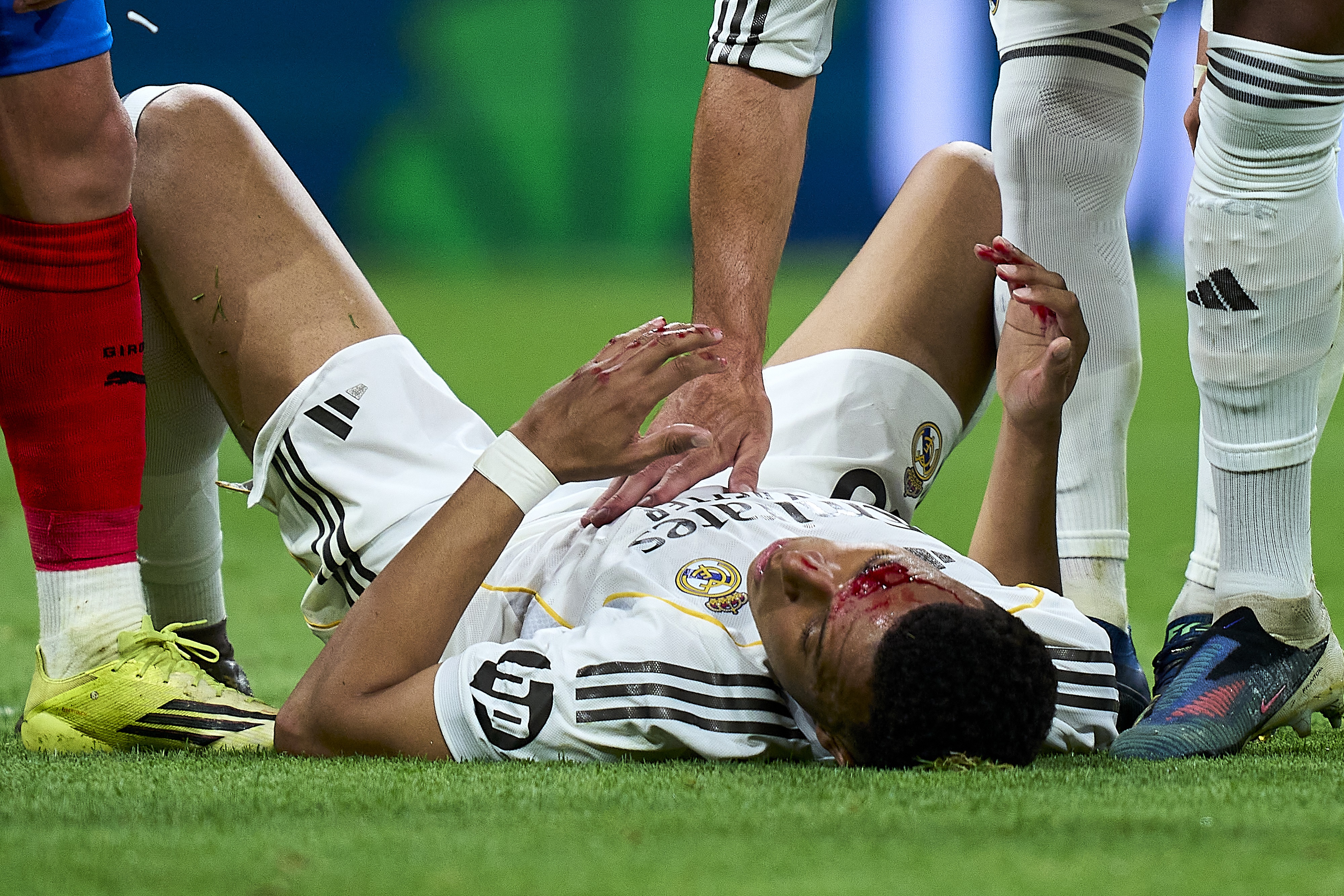 Kylian Mbappé sérülése.