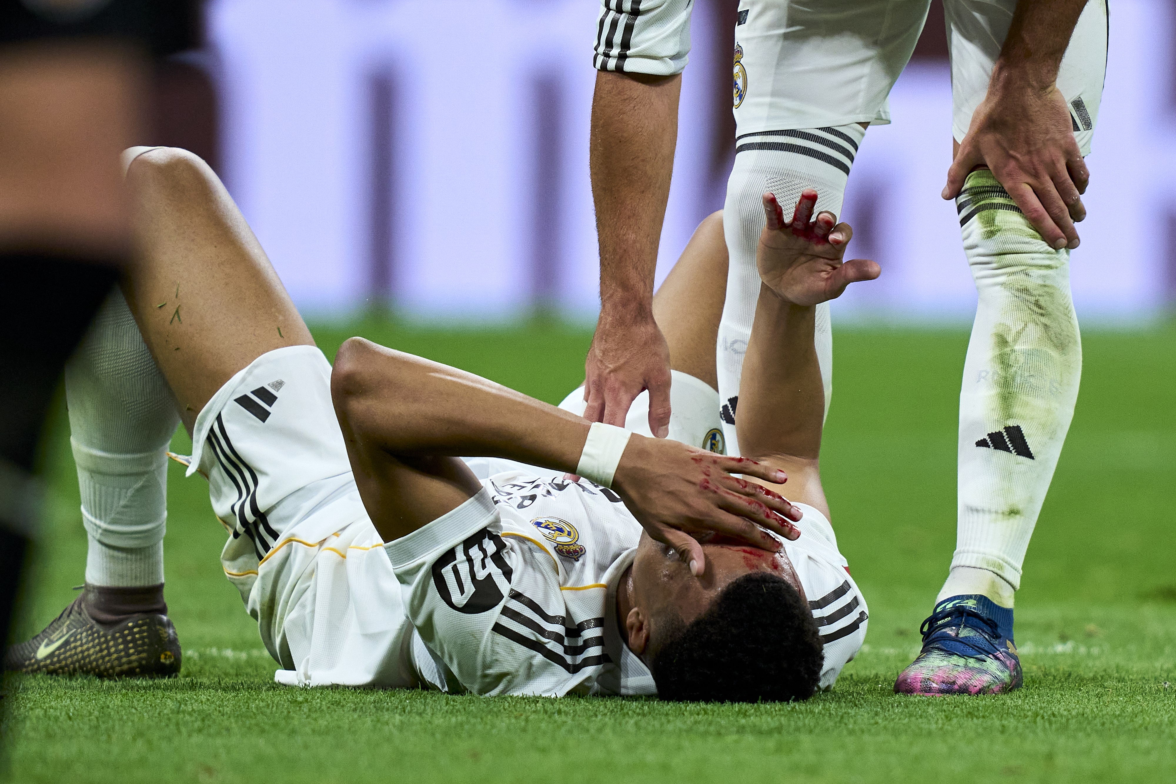 Kylian Mbappé sérülése.