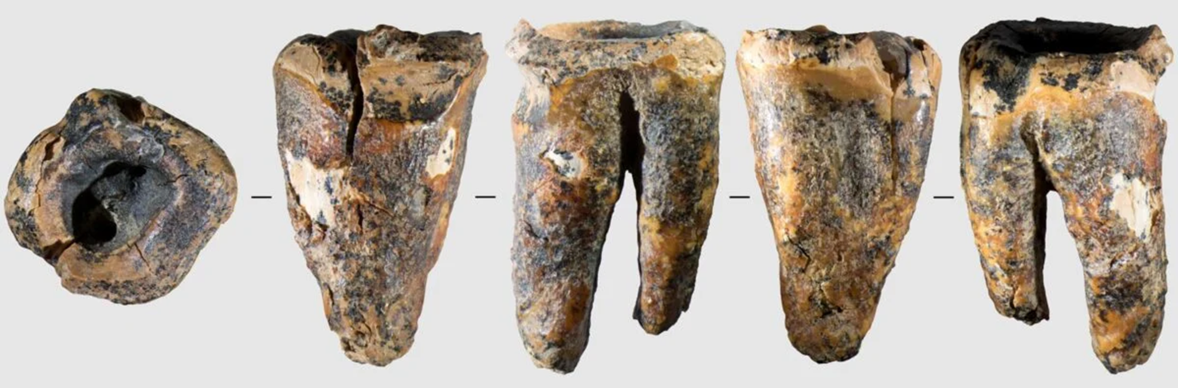 neandervölgyi, fogorvos, kezelés, kutatás, oroszország