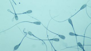 sperma, spermium, termékenység, kemoterápia, kutatás, műtét,