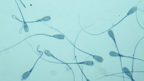 sperma, spermium, termékenység, kemoterápia, kutatás, műtét,