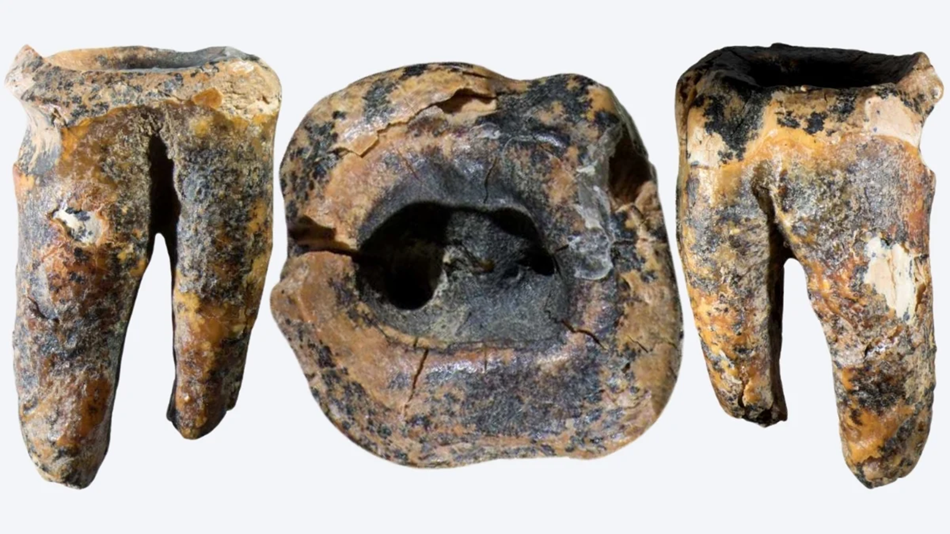 neandervölgyi, fogorvos, kezelés, kutatás, oroszország