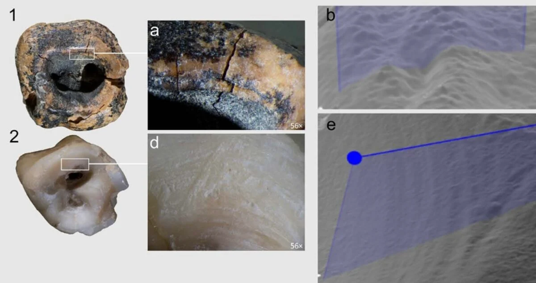 neandervölgyi, fogorvos, kezelés, kutatás, oroszország