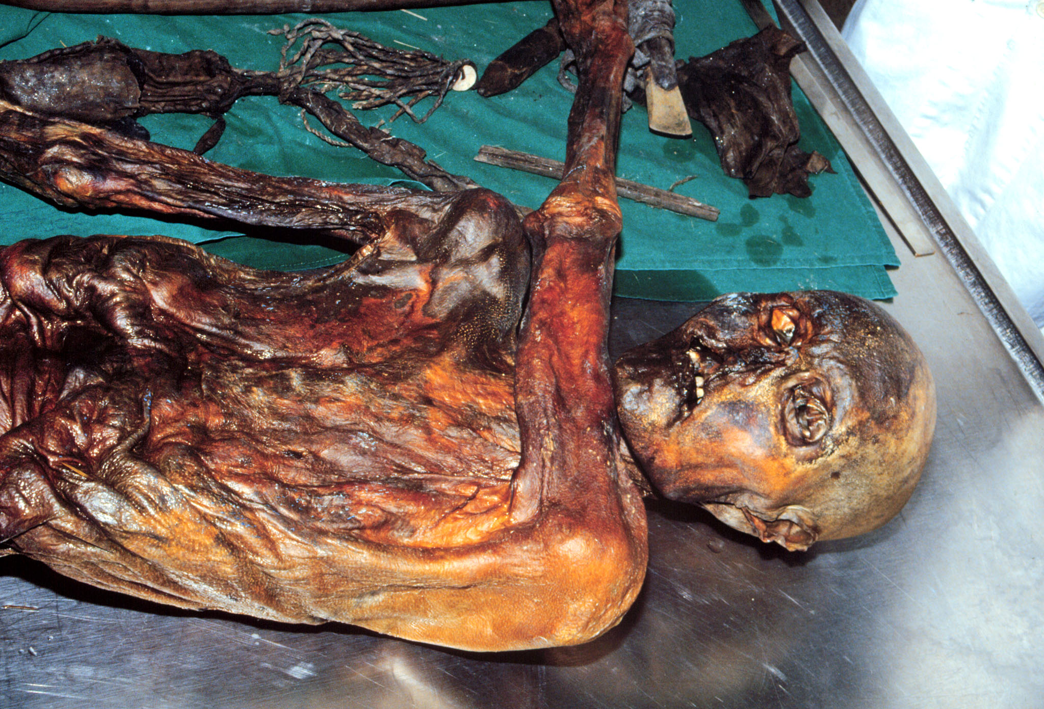 ötzi, jégmúmia, kutatás, gomba, mikrobiális élet