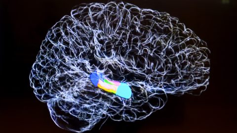 agy, depresszió, pacemaker, kutatás, majom, terápiarezisztens depresszió, súlyos depresszió
