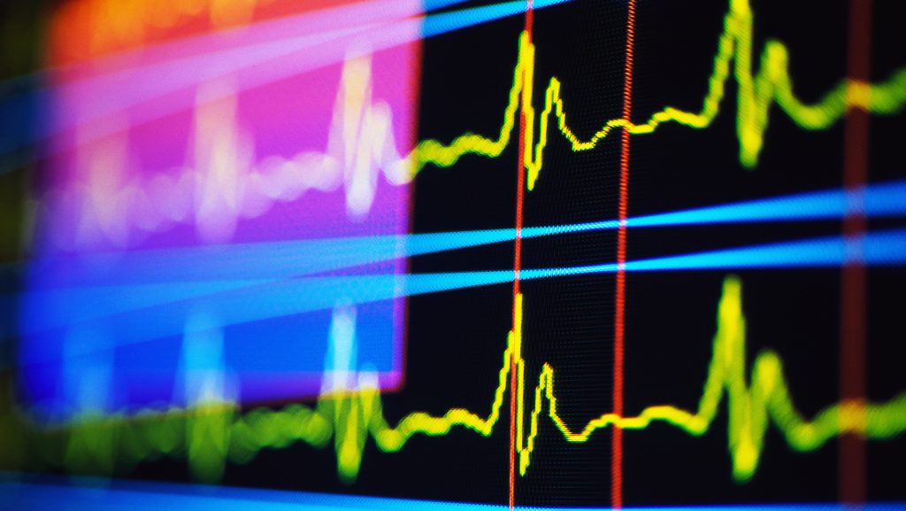 Két másodperc alatt kiszúrja a szívbetegségeket egy új mesterséges intelligencia