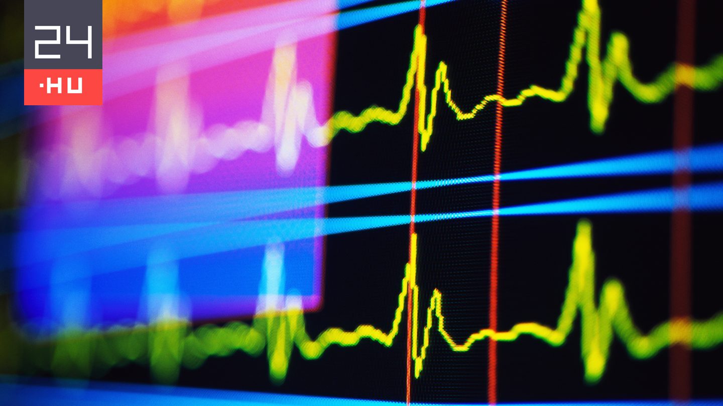 Photo: 24.hu L'IA détecte le Diabète et l'Hypertension via une Vidéo Faciale de 5 Secondes
