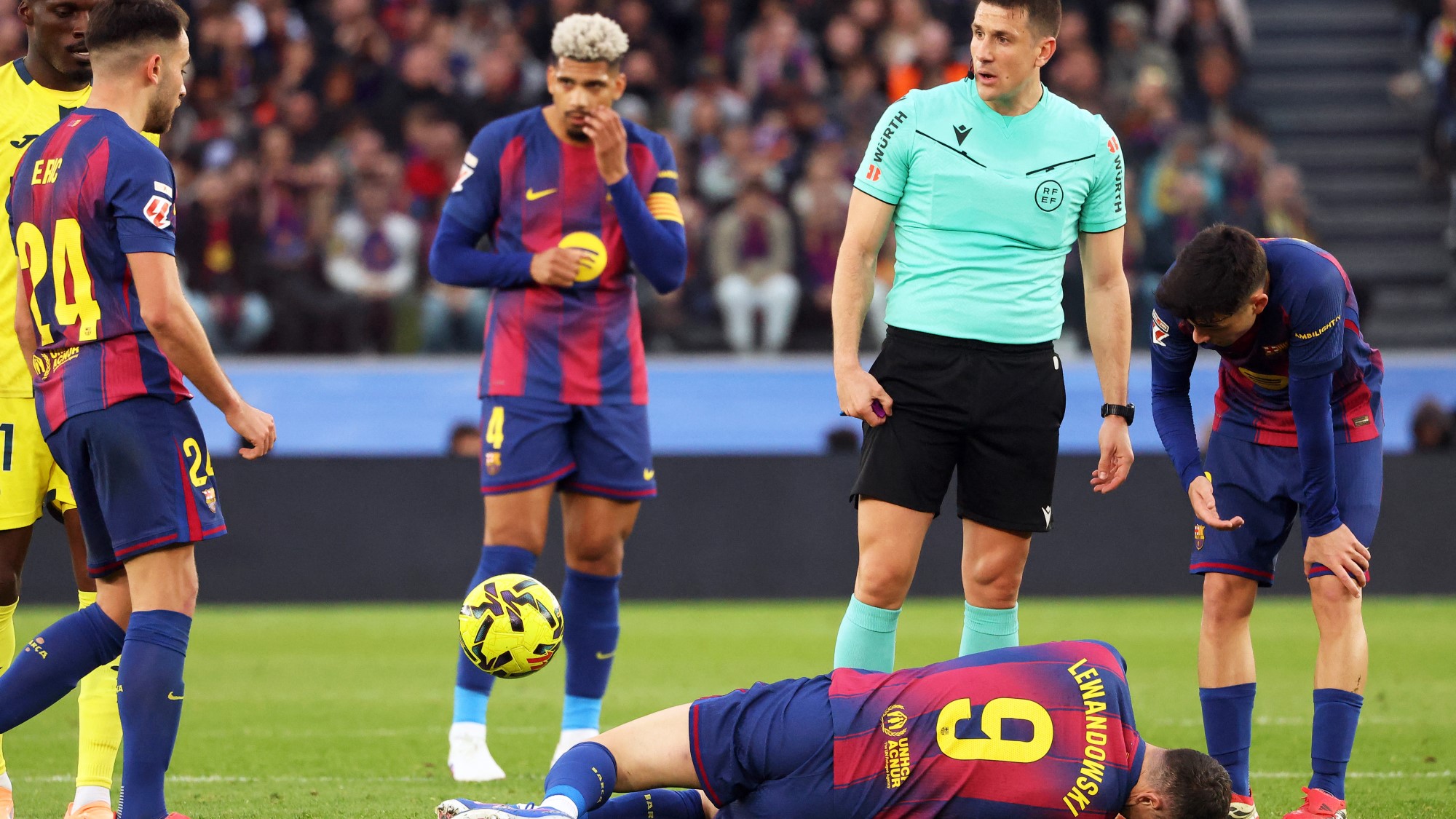 Robert Lewandowski szemüregtörés barcelona