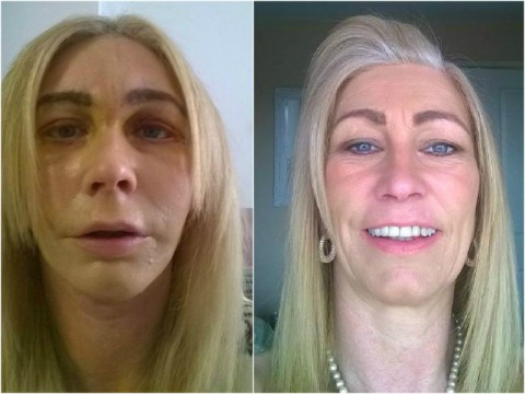 Andrea Dalzell (Array)